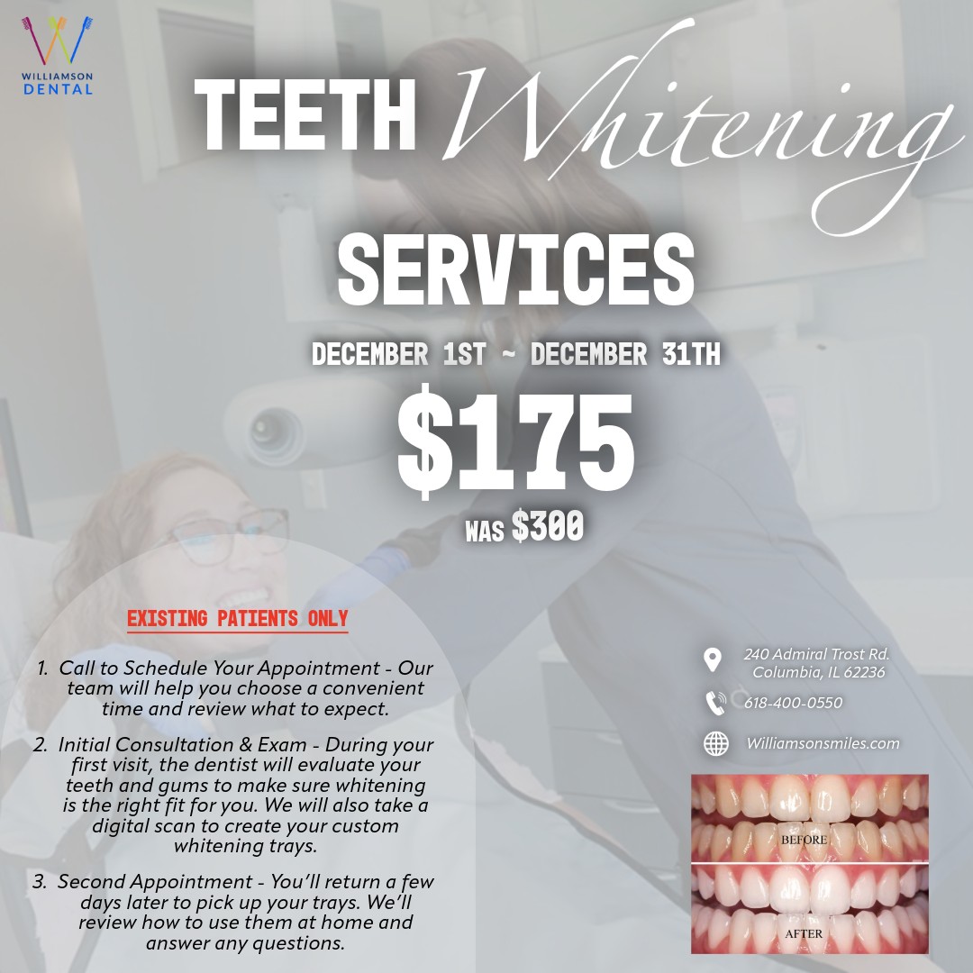 Teeth Whitening Special
